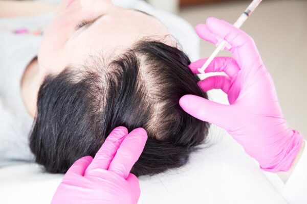 Hair Transplant